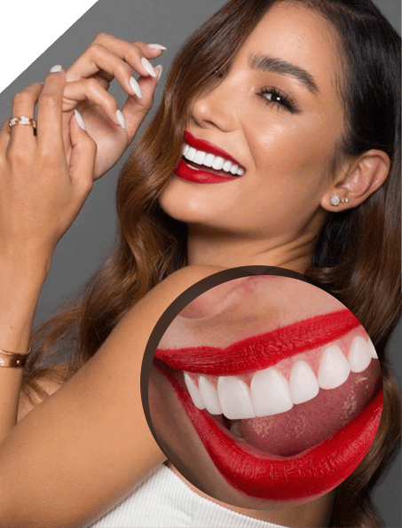 dent